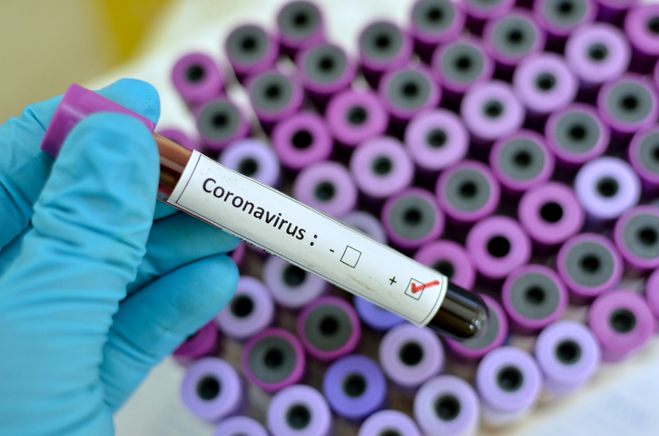 Coronavirus, il bollettino